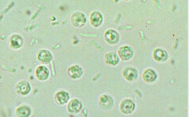 3–Cryptosporidium 3