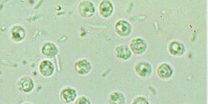 3–Cryptosporidium 3